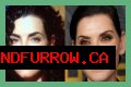 Julianna Margulies Doesn’t Look Natural After Plastic Surgery!